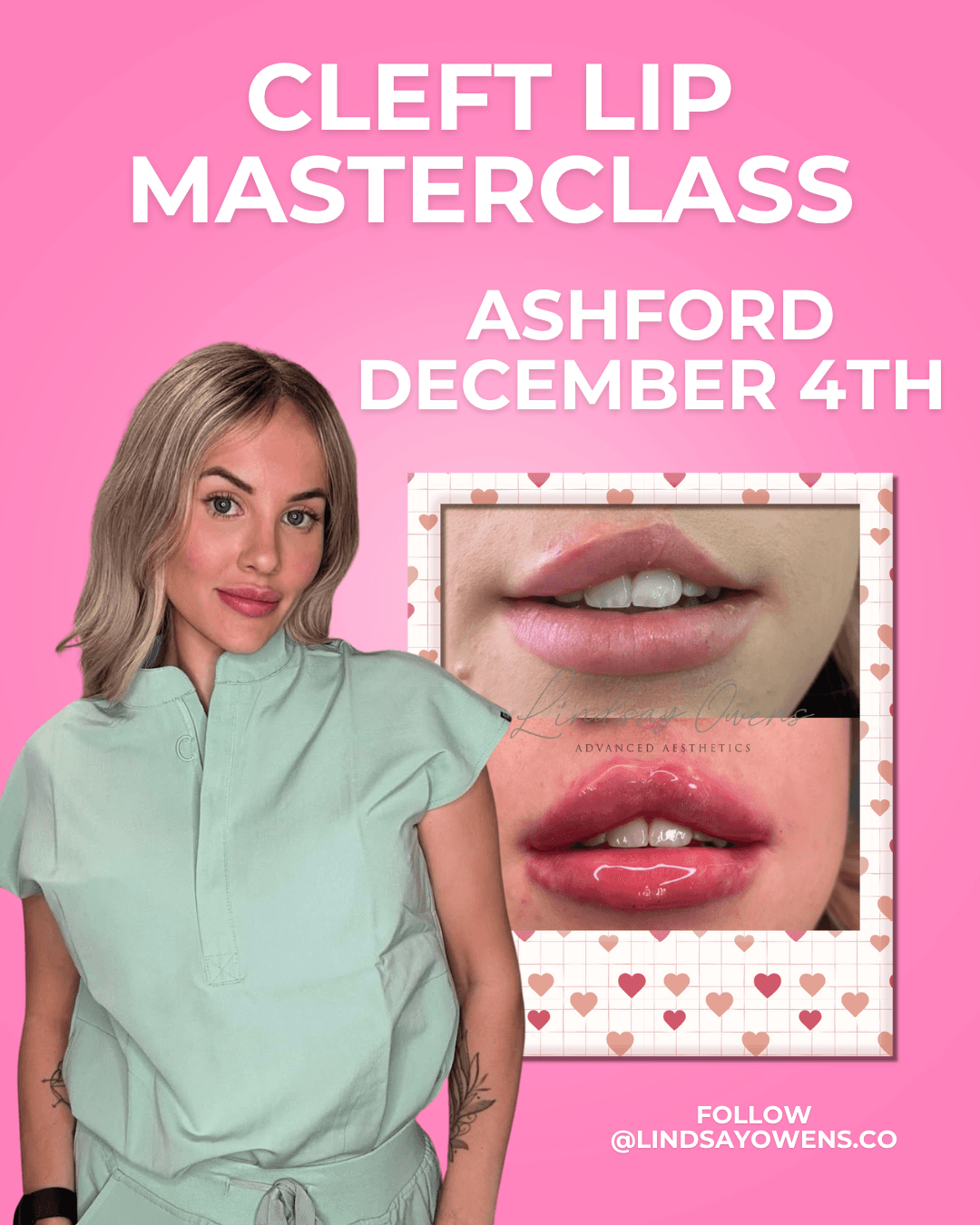 Cleft Lip Masterclass - Ashford