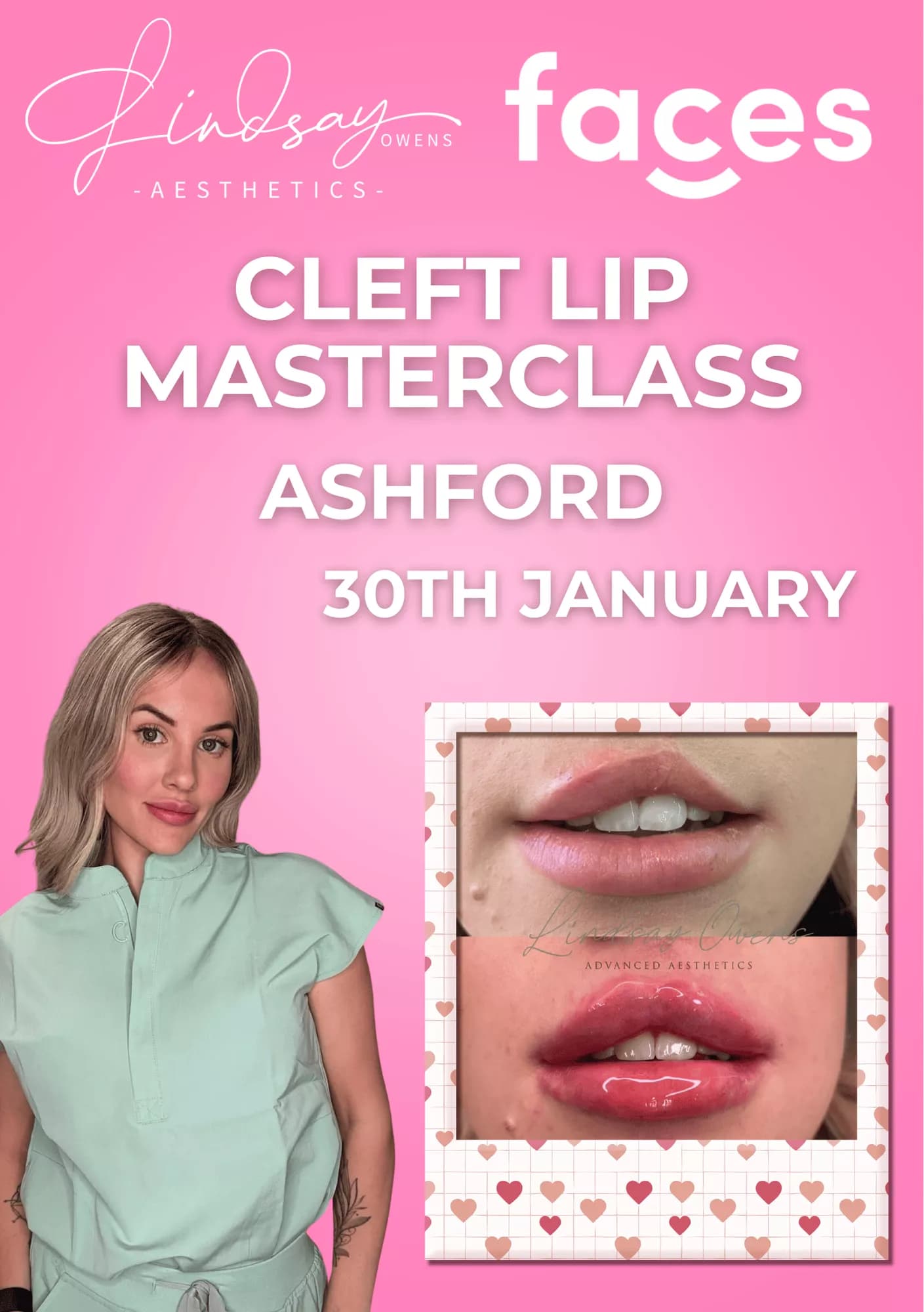 Cleft Lip Masterclass - Ashford